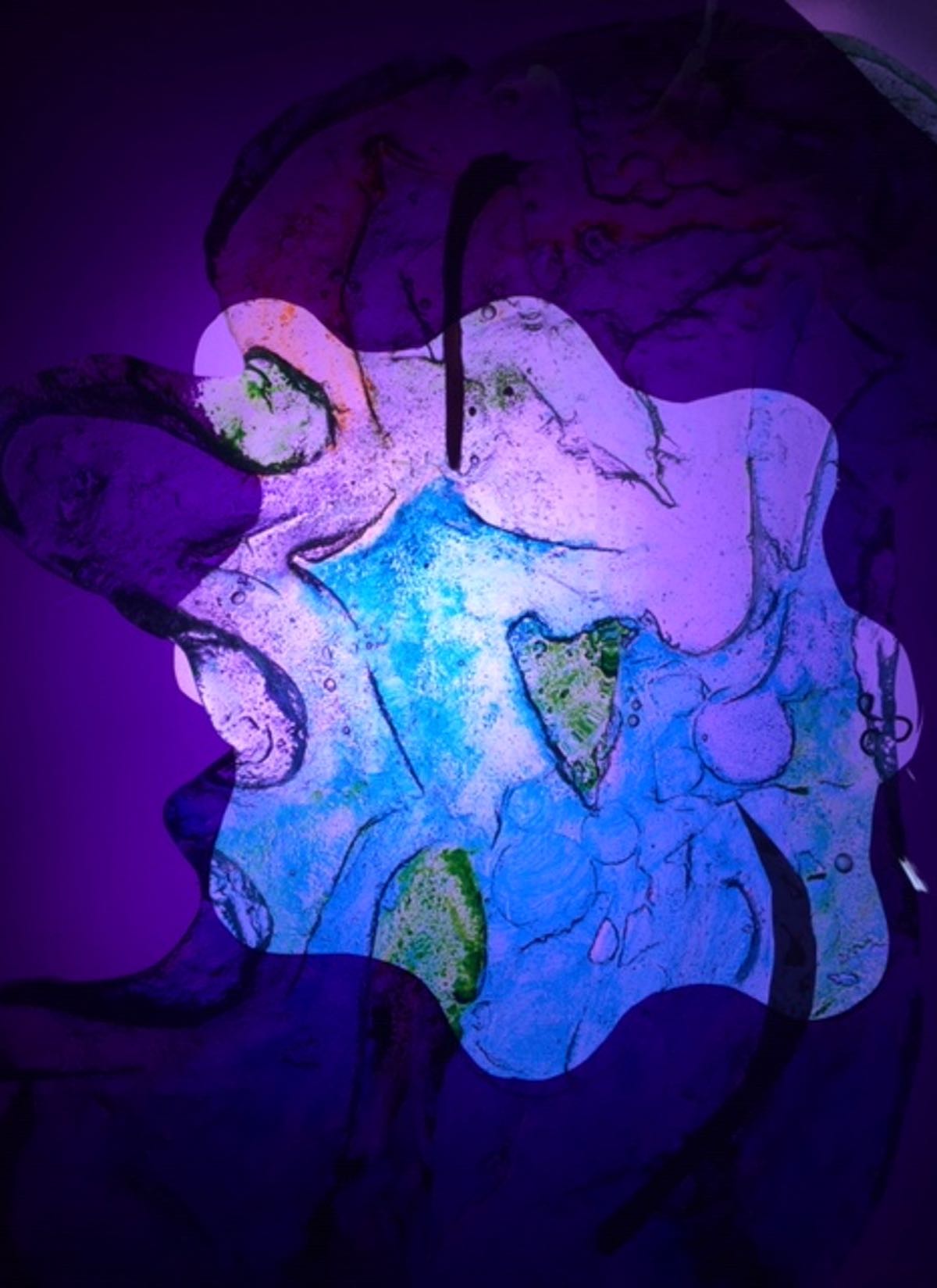 Amoeba 1
